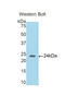Coiled-Coil Domain Containing 80 antibody, LS-C293411, Lifespan Biosciences, Western Blot image 