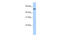 Target Of EGR1, Exonuclease antibody, 30-814, ProSci, Western Blot image 