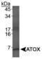 Antioxidant 1 Copper Chaperone antibody, PA5-22973, Invitrogen Antibodies, Western Blot image 