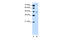 Atypical Chemokine Receptor 2 antibody, 27-311, ProSci, Western Blot image 