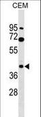 Calcium Voltage-Gated Channel Auxiliary Subunit Gamma 3 antibody, LS-C159254, Lifespan Biosciences, Western Blot image 