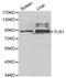 Toll Like Receptor 1 antibody, LS-C192322, Lifespan Biosciences, Western Blot image 