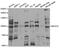MER Proto-Oncogene, Tyrosine Kinase antibody, TA332689, Origene, Western Blot image 