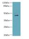 Calsequestrin 1 antibody, LS-C396068, Lifespan Biosciences, Western Blot image 