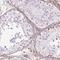 Calponin 3 antibody, NBP2-38643, Novus Biologicals, Immunocytochemistry image 