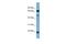 Zinc Finger Protein 746 antibody, A10848, Boster Biological Technology, Western Blot image 