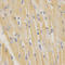 Surfactant Protein C antibody, LS-C331717, Lifespan Biosciences, Immunohistochemistry paraffin image 