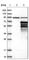 Meis Homeobox 2 antibody, HPA003256, Atlas Antibodies, Western Blot image 