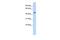 Ring Finger Protein 133 antibody, GTX46893, GeneTex, Western Blot image 