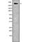 Chromodomain Helicase DNA Binding Protein 8 antibody, abx149282, Abbexa, Western Blot image 