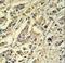 Sphingomyelin Phosphodiesterase Acid Like 3A antibody, LS-C156542, Lifespan Biosciences, Immunohistochemistry paraffin image 