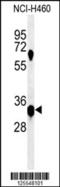 Potassium Channel Tetramerization Domain Containing 1 antibody, 61-729, ProSci, Western Blot image 