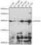 ATPase Phospholipid Transporting 10A (Putative) antibody, A08170, Boster Biological Technology, Western Blot image 
