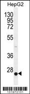 Calcium Voltage-Gated Channel Auxiliary Subunit Gamma 6 antibody, MBS9205773, MyBioSource, Western Blot image 