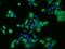 Major Histocompatibility Complex, Class I, E antibody, 204426-T02, Sino Biological, Immunohistochemistry paraffin image 