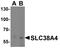 Solute Carrier Family 38 Member 4 antibody, PA5-72879, Invitrogen Antibodies, Western Blot image 