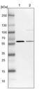 Uridine Monophosphate Synthetase antibody, PA5-57560, Invitrogen Antibodies, Western Blot image 