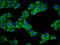 RRAD And GEM Like GTPase 1 antibody, LS-C681203, Lifespan Biosciences, Immunofluorescence image 