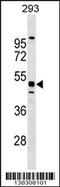 Testis Expressed Metallothionein Like Protein antibody, 59-646, ProSci, Western Blot image 