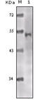 Lysine Acetyltransferase 5 antibody, abx010956, Abbexa, Enzyme Linked Immunosorbent Assay image 