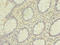Heterogeneous Nuclear Ribonucleoprotein L antibody, LS-C375900, Lifespan Biosciences, Immunohistochemistry paraffin image 