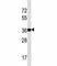 Nanog Homeobox antibody, F40208-0.4ML, NSJ Bioreagents, Western Blot image 