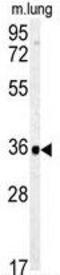 Carbonic Anhydrase 4 antibody, GTX81426, GeneTex, Western Blot image 