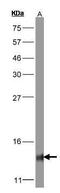 Cytochrome C Oxidase Subunit 5B antibody, GTX101486, GeneTex, Western Blot image 