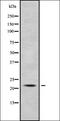 Potassium Calcium-Activated Channel Subfamily M Regulatory Beta Subunit 1 antibody, orb338097, Biorbyt, Western Blot image 