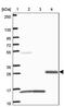 Von Willebrand Factor C Domain Containing 2 antibody, PA5-63097, Invitrogen Antibodies, Western Blot image 
