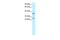 Sirtuin 5 antibody, PA5-40535, Invitrogen Antibodies, Western Blot image 