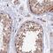 Relaxin 3 antibody, NBP2-47308, Novus Biologicals, Immunohistochemistry frozen image 