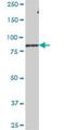 Leucine Rich Repeat And Sterile Alpha Motif Containing 1 antibody, H00090678-B01P, Novus Biologicals, Western Blot image 