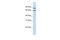 IKAROS Family Zinc Finger 1 antibody, ARP31470_P050, Aviva Systems Biology, Western Blot image 