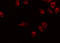 Smoothened, Frizzled Class Receptor antibody, GTX02530, GeneTex, Immunocytochemistry image 