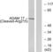 ADAM Metallopeptidase Domain 17 antibody, abx015548, Abbexa, Western Blot image 