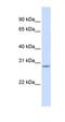 Scratch Family Transcriptional Repressor 2 antibody, orb325598, Biorbyt, Western Blot image 