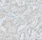 ADP Ribosylation Factor 6 antibody, A00927, Boster Biological Technology, Immunohistochemistry paraffin image 