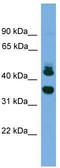 Sorting Nexin 32 antibody, TA329789, Origene, Western Blot image 