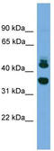 Sorting Nexin 32 antibody, TA329789, Origene, Western Blot image 