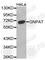 Glyceronephosphate O-Acyltransferase antibody, A4220, ABclonal Technology, Western Blot image 