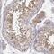 ERGIC And Golgi 2 antibody, PA5-65576, Invitrogen Antibodies, Immunohistochemistry paraffin image 