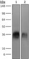 Cytotoxic T-Lymphocyte Associated Protein 4 antibody, GTX14132, GeneTex, Western Blot image 