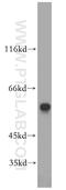 Polo Like Kinase 1 antibody, 10305-1-AP, Proteintech Group, Western Blot image 