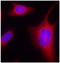 Protein Kinase D1 antibody, LS-C335826, Lifespan Biosciences, Immunofluorescence image 