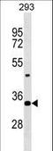 Homeobox D9 antibody, LS-C158213, Lifespan Biosciences, Western Blot image 