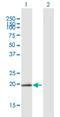 Lysozyme G1 antibody, H00129530-B01P, Novus Biologicals, Western Blot image 