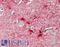 ATP Binding Cassette Subfamily A Member 8 antibody, LS-B13624, Lifespan Biosciences, Immunohistochemistry paraffin image 