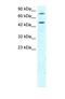 Regulator Of G Protein Signaling 9 antibody, NBP1-58919, Novus Biologicals, Western Blot image 