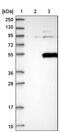 Phosphatidylinositol-5-Phosphate 4-Kinase Type 2 Gamma antibody, PA5-55935, Invitrogen Antibodies, Western Blot image 